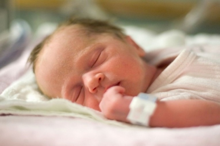 حالة نادرة جدا لأول مرة في تونس : مولود يحمل شقيقه التوأم في بطنه