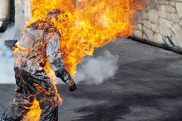 توزر: خمسيني يضرم النار في جسده وهو في حالة سكر