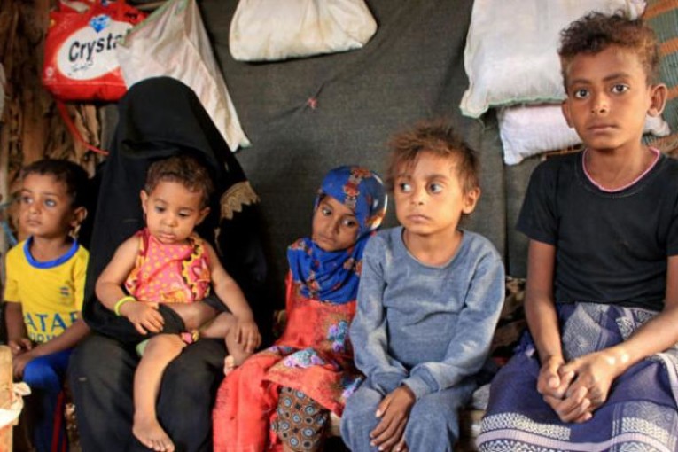 اليمن : أكثر من مليوني طفل يعانون من سوء تغذية حاد