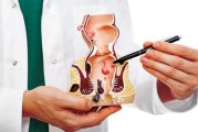آلام البواسير… مشكلة شائعة لا تحتمل التأجيل