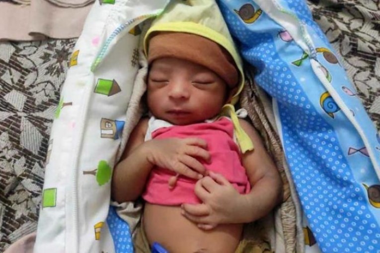 مولود هندي بـ24 إصبعا يثير دهشة الأطباء