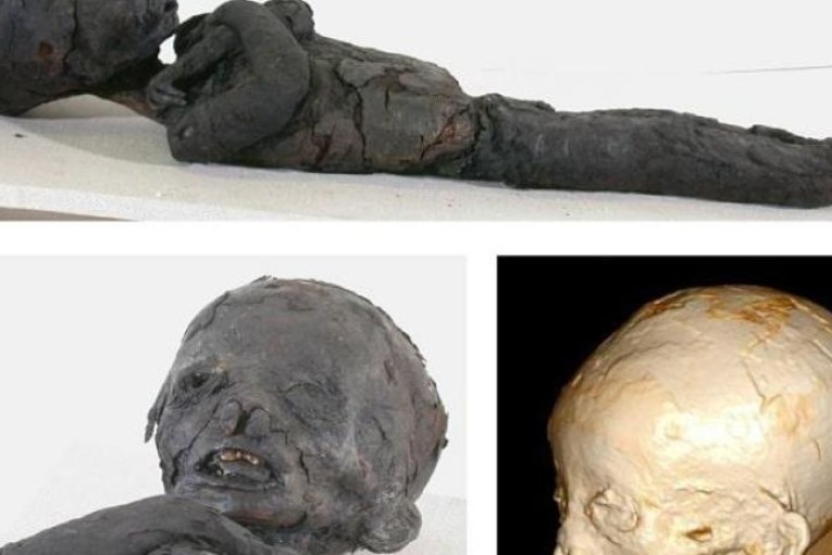 دراسة: فقر الدم كان شائعاً لدى الأطفال في مصر القديمة