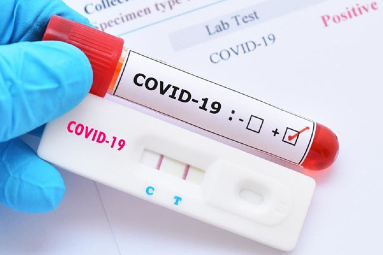 تسجيل 3 وفيات و129 إصابة جديدة بفيروس كورونا