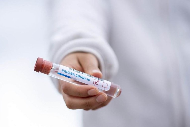 كورونا: 265 إصابة جديدة والتحاليل الإيجابية تتجاوز 27%